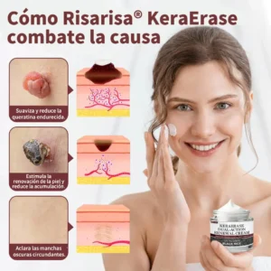 Risarisa® KeraErase Crema Renovadora de Doble Acción🔔