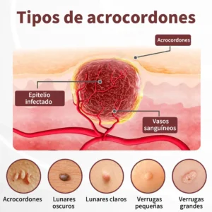 Risarisa® KeraErase Crema Renovadora de Doble Acción🔔