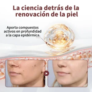 Risarisa® KeraErase Crema Renovadora de Doble Acción🔔
