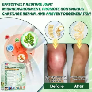 𝐎𝐟𝐟𝐢𝐜𝐢𝐚𝐥 𝐔𝐒 𝐒𝐭𝐨𝐫𝐞 🇺🇸  | 🧑‍⚕️🩺 RISARISA® Moringa · Berberine × NAD+ 𝟏𝟎-𝐢𝐧-𝟏 𝐀𝐝𝐯𝐚𝐧𝐜𝐞𝐝 𝐍𝐚𝐧𝐨 𝐌𝐢𝐜𝐫𝐨𝐧𝐞𝐞𝐝𝐥𝐞 𝐏𝐚𝐭𝐜𝐡 — 𝐎𝐧𝐜𝐞 𝐃𝐚𝐢𝐥𝐲, 𝐕𝐢𝐬𝐢𝐛𝐥𝐞 𝐑𝐞𝐬𝐮𝐥𝐭𝐬 𝐢𝐧 𝟕 𝐃𝐚𝐲𝐬 👍